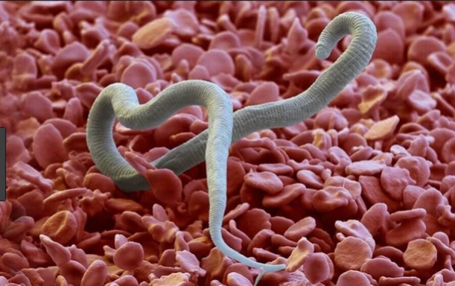 worms in the human body