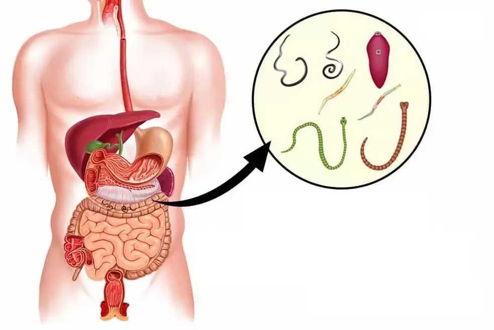 worms are parasites in the human gut