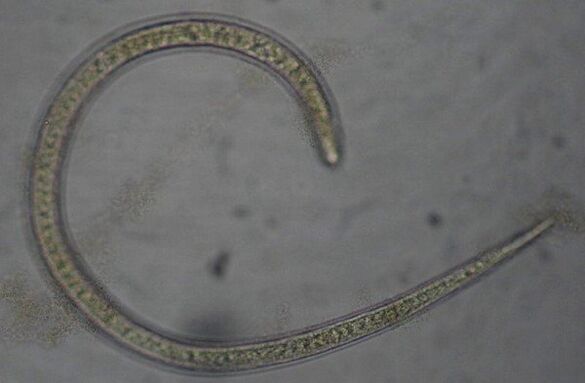 Trichinella is a protostome roundworm parasite