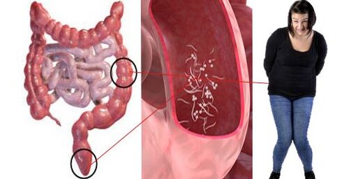 Parasites in the body