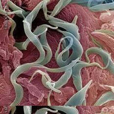 Helminth